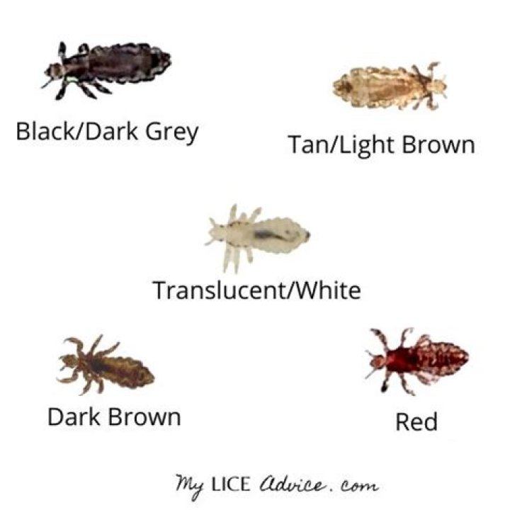 Are lice black?