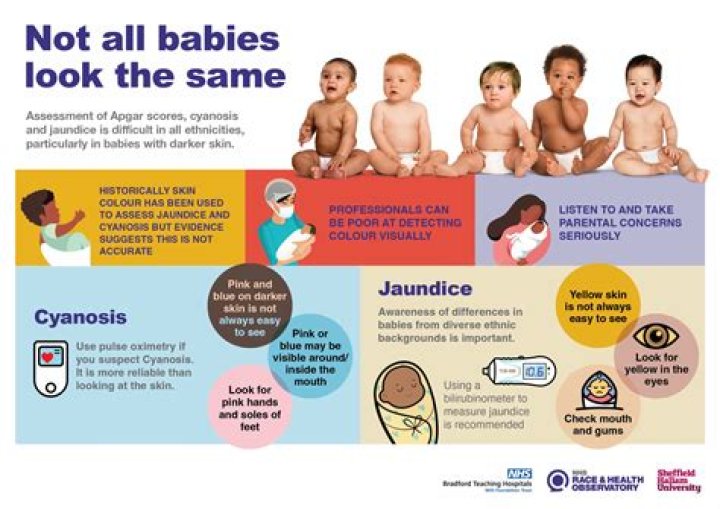 Are newborns at risk for Covid?