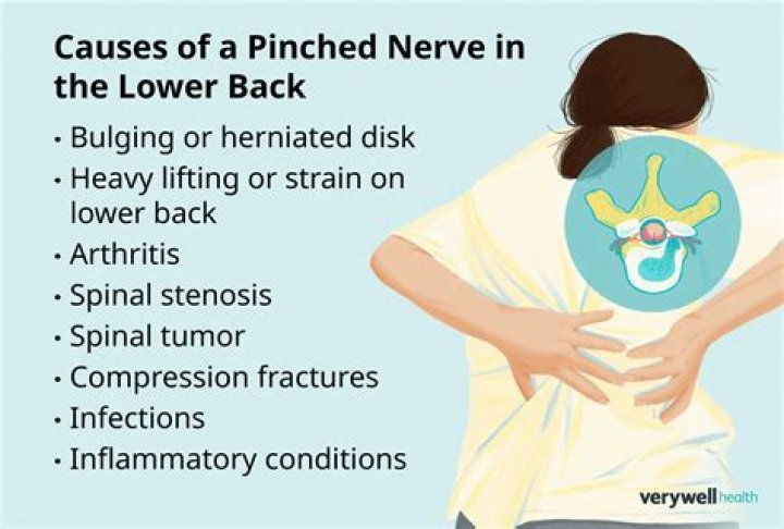 Can a pinched nerve in lower back cause bowel problems?