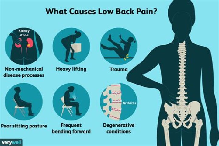 Can bowel problems cause lower back pain?