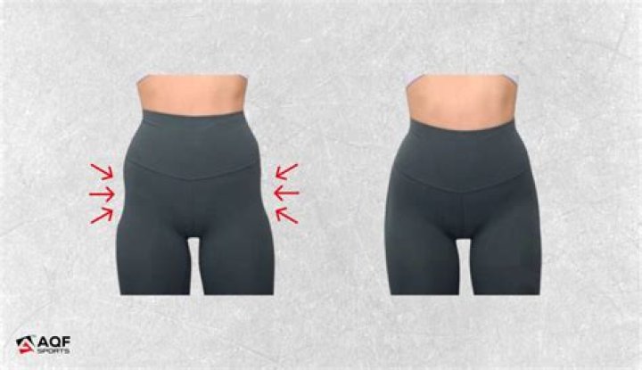 Can dimples be removed?