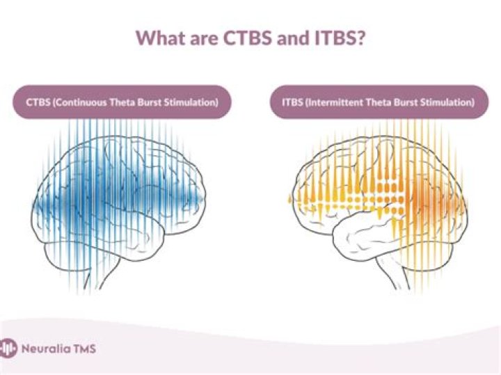 Can stress bring on CFS?
