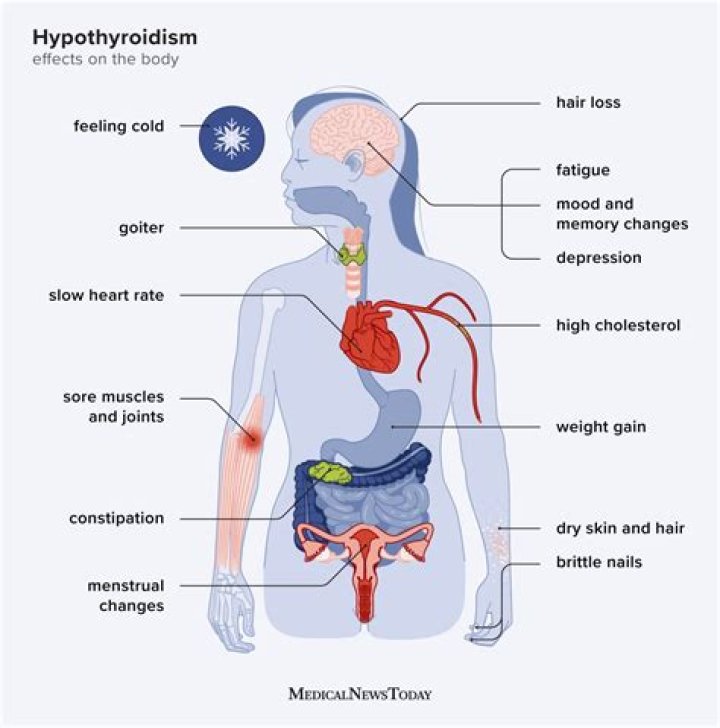 Can thyroid affect your bowels?