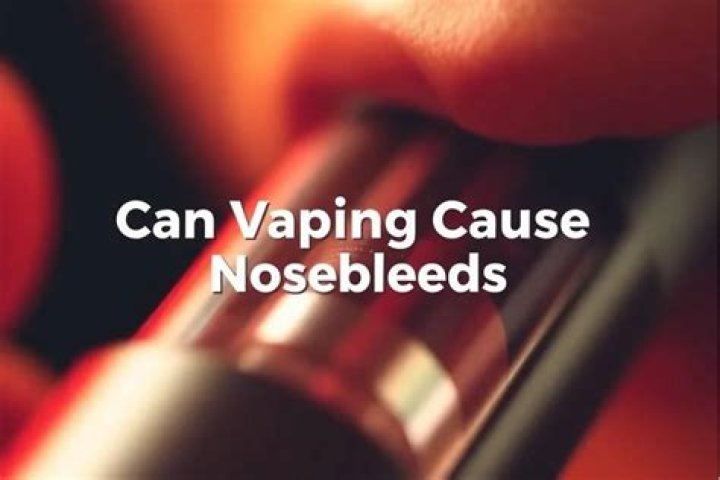 Can vaping cause nosebleeds?