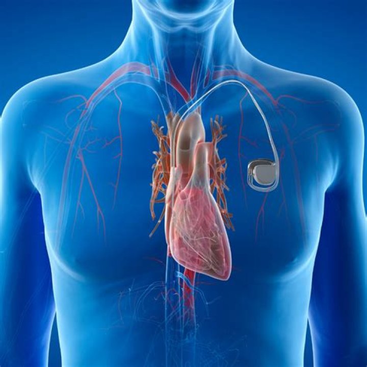 Can you have an MRI scan with a defibrillator?