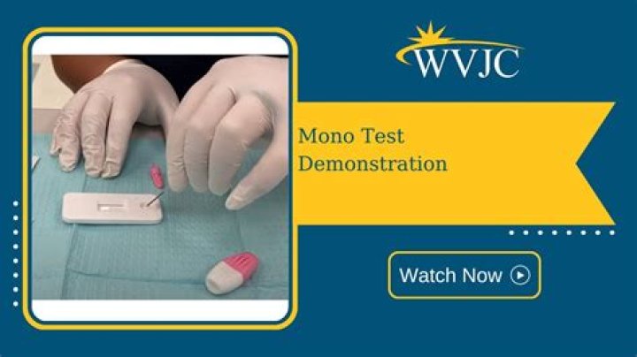 Do you always test positive for mono after having it?