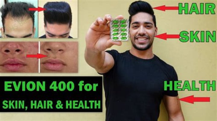 Does Evion 400 regrow hair?