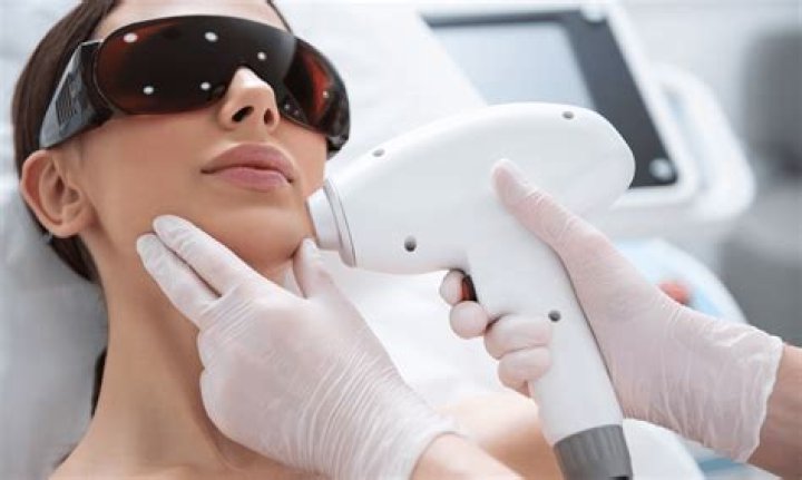 Does laser hair removal on face cause more hair?