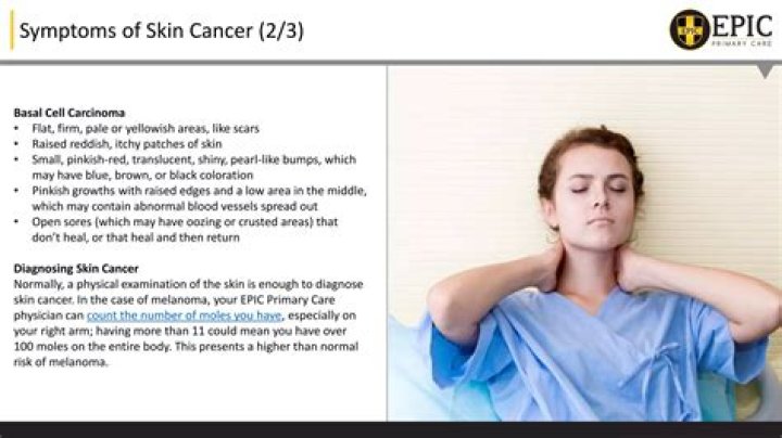 Does melanoma require chemo?