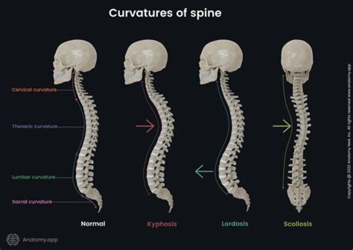 How can I heal my spine naturally?