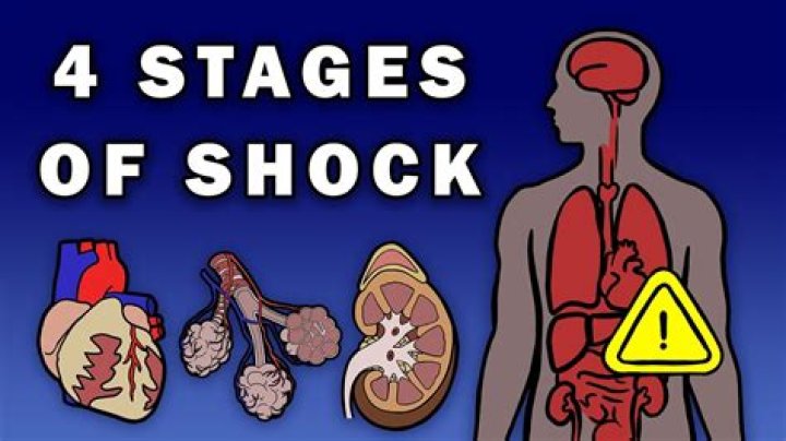 How do I get shock in Skyrim?