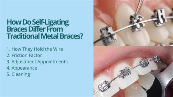 How do you help braces work faster?