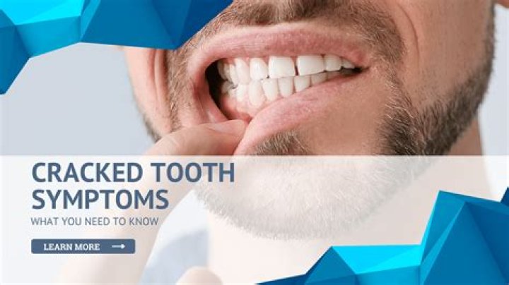 How long can you keep a cracked tooth?
