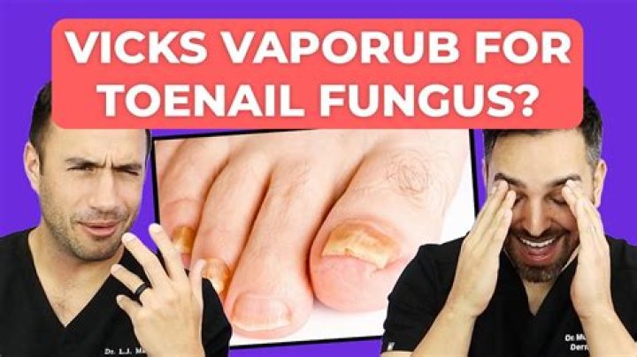 How long does it take for Vicks to work on toenail fungus?