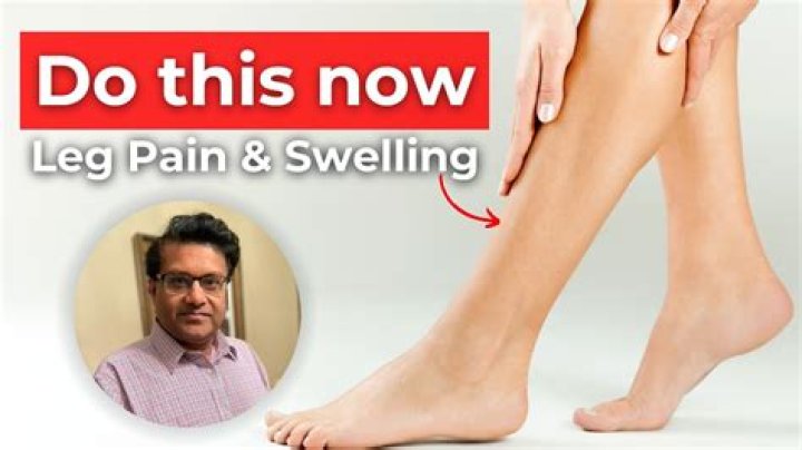 How much should you walk when you have a blood clot in your leg?