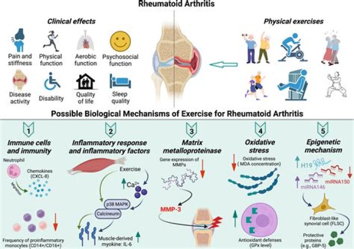 Is rheumatoid arthritis a death sentence?