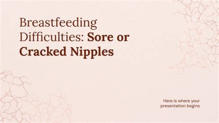Should I still nurse with cracked nipples?