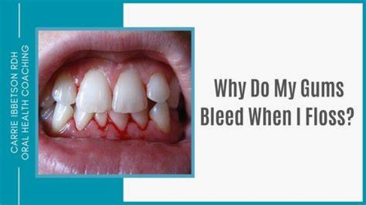 Should your gums move when flossing?