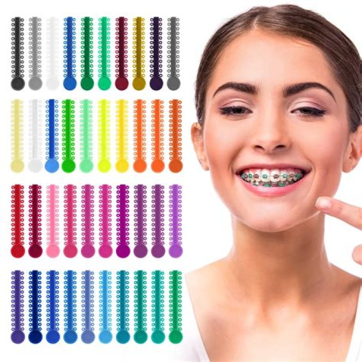 What color braces should a girl get?