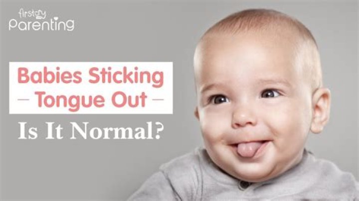 What does it mean when a baby has a big forehead?