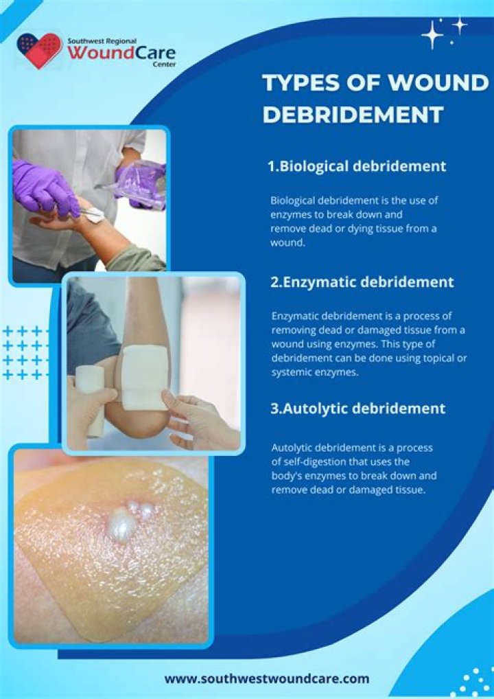 What happens if you don't debride a wound?