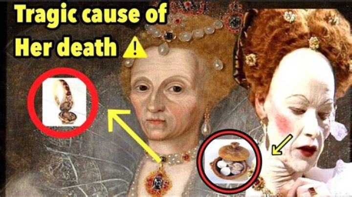 What illness did Queen Elizabeth 1 have?