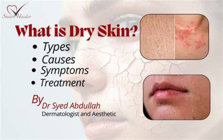 What is dry skin lacking?