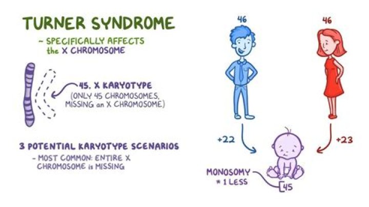 What is the difference between Klinefelter's syndrome and Turner syndrome?