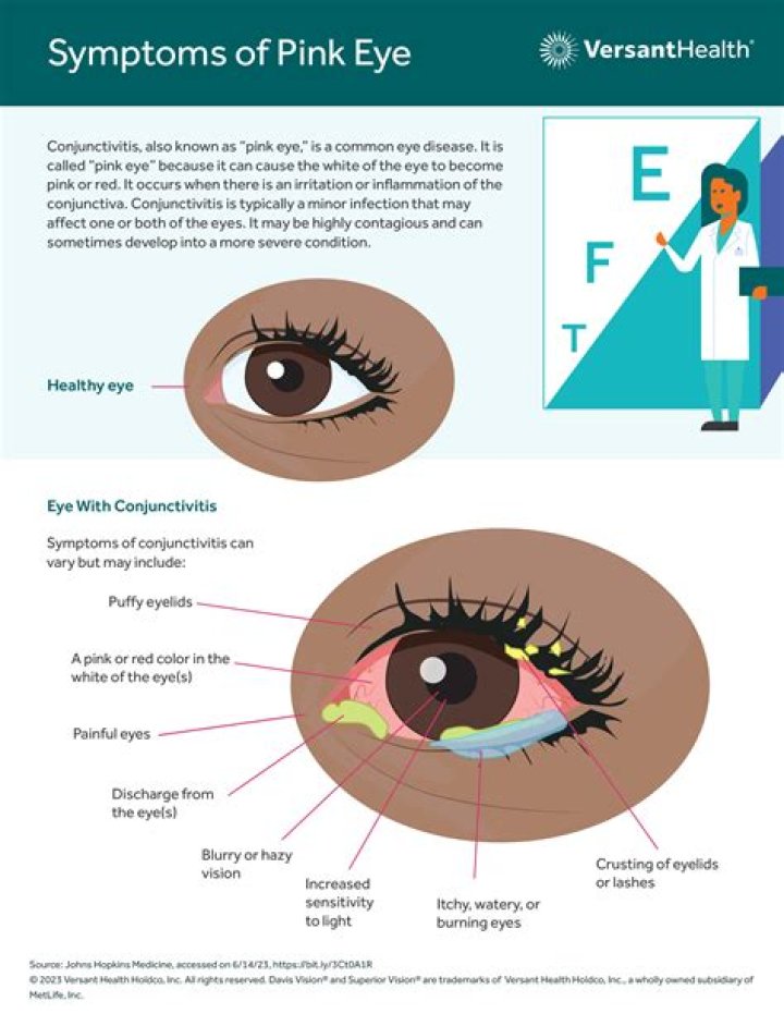 What is the pink part in the corner of your eye?
