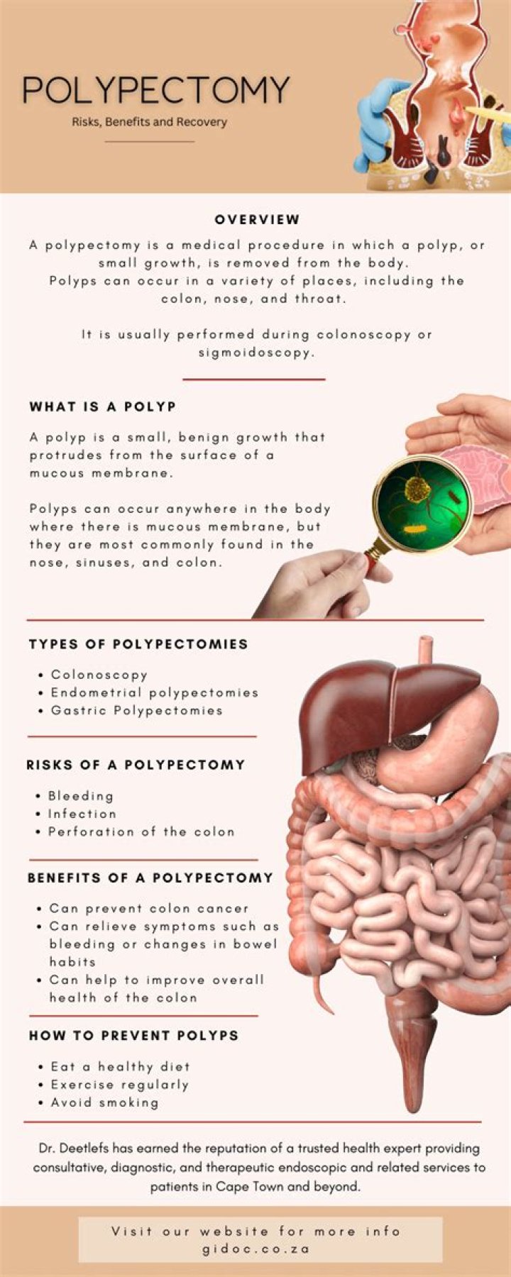 What is the recovery time for colon polyp removal?