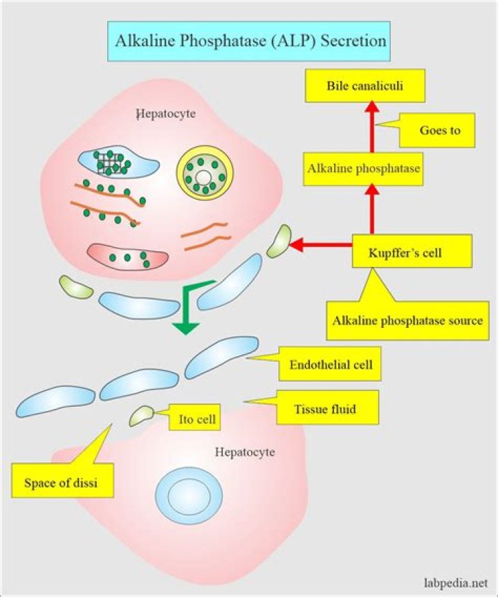 What is the treatment for high alkaline phosphatase?