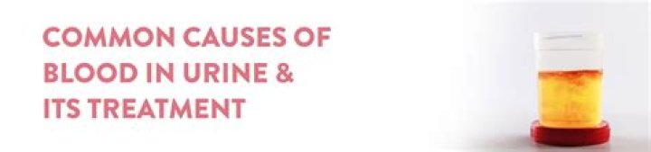 When should I worry about blood in urine?