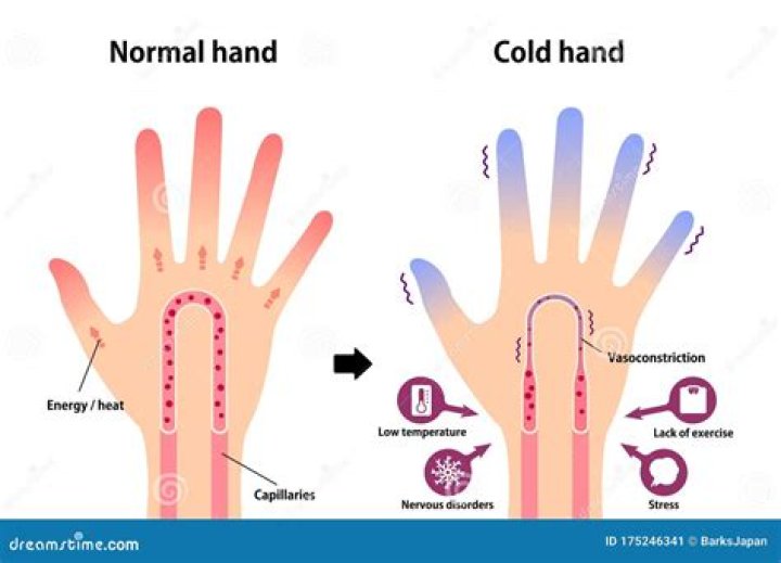Why are my hands cold but my body is warm?