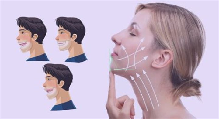 Why does my chin poke out?
