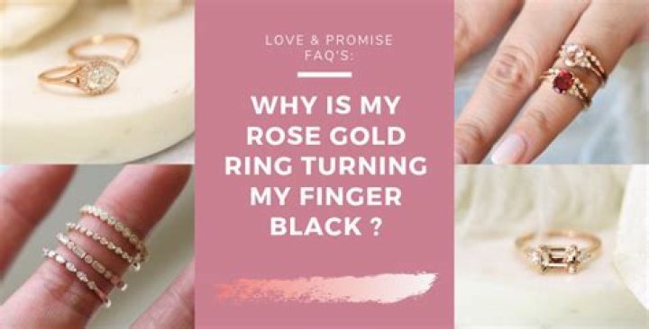 Why is my rose gold ring turning black?