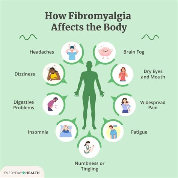 Will CBD help with fibromyalgia?