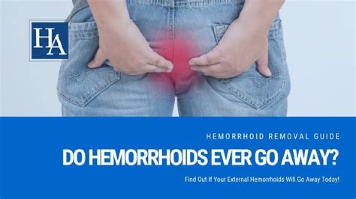 Will external hemorrhoids go away?